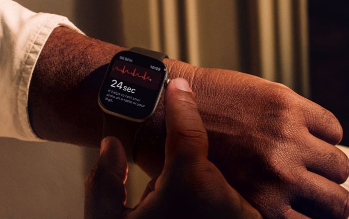 Apple Watch Series 11 are design modern